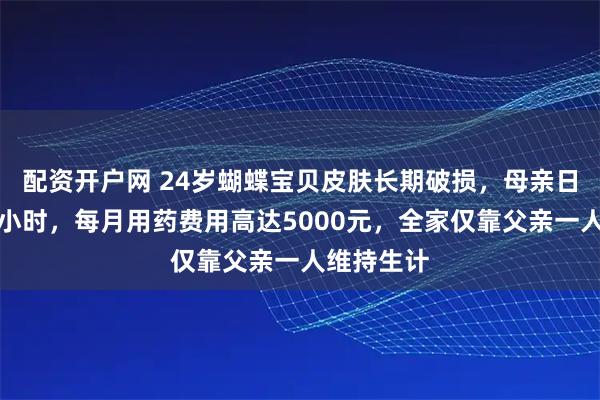 配资开户网 24岁蝴蝶宝贝皮肤长期破损，母亲日均护理数小时，每月用药费用高达5000元，全家仅靠父亲一人维持生计
